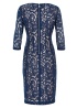 Patrice Lace Dress