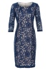 Patrice Lace Dress
